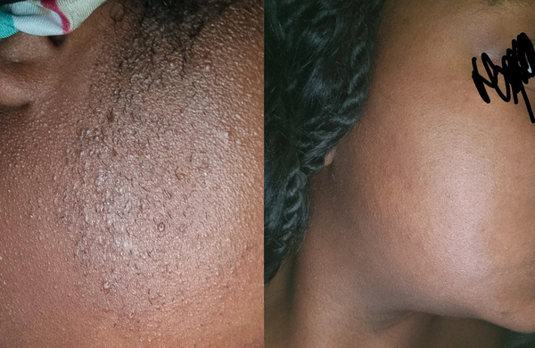Customer review image